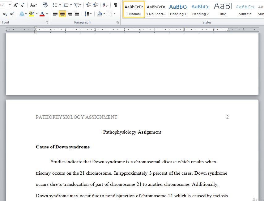 pathophysiology and down syndrome assignment
